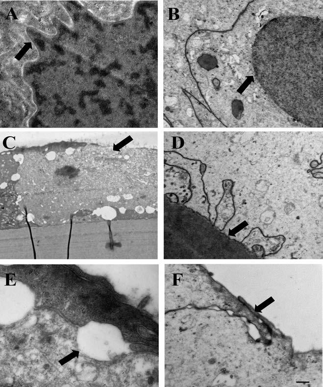 Morphological characteritics of cell damage zsugorodás következtében szabálytalan alakú volt, míg a sejtmag hártyája folytonos maradt (2. A ábra). A citoplazmát illetően is különbséget láttunk az I.