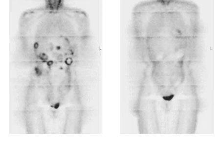 CLINICAL DISCOVERY OF KIT-IMATINIB DRIVER-DRUG PAIR IN GIST REPORTED IN CASE REPORT AWARD