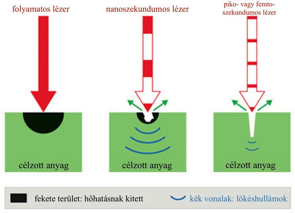 megtervezhető lett, valamint a preoperatív corneális asztigmia is pontosan adagoltan kezelhetővé vált a femtoszekundum lézeres relaxációs incíziók készítése révén.