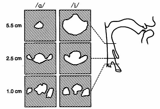 esetén is beindul a zöngeképzés (összefoglalóan: Titze 2008, Titze et al. 2008). Mind a szupra-, mind a szubglottális üregek mindenkori aerodinamikai sajátosságai hatással vannak a zöngeképzésre.