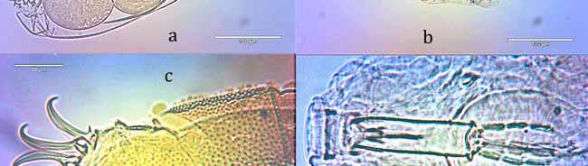 richtersi, c: Echiniscus canadensis a IV.