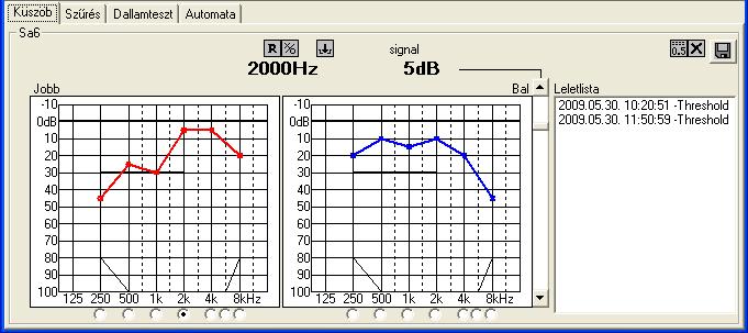 6.2. Sa-6 audiométer kezelése Az Sa-6 készülékkel négy féle küszöbvizsgálat végezhetı: küszöb, szőrés, dallamteszt és automata mérés.