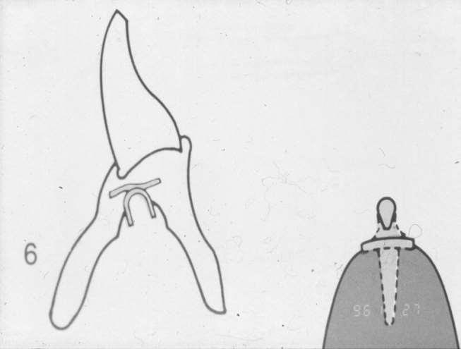 (Dolder-féle