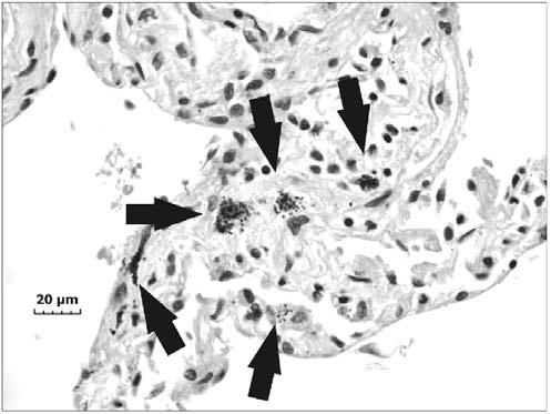 Részecskeméret eloszlás BRAND P., LENZ K., REISGEN U. and KRAUS t., Number Size Distribution of Fine and Ultrafine Fume Particles From Various Welding Processes. Ann. Occup. Hyg., Vol. 57, No. 3, pp.