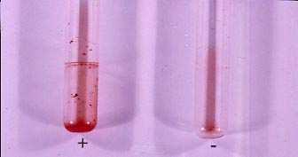 Exopolysaccharid mátrix (slime) termelésének vizsgálata koaguláz