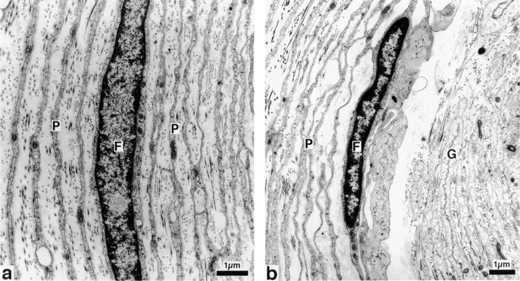 Perineural kapszula elektron mikroszkópos képe a: perineurális kapszula b: