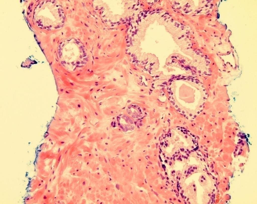 BIOPSI