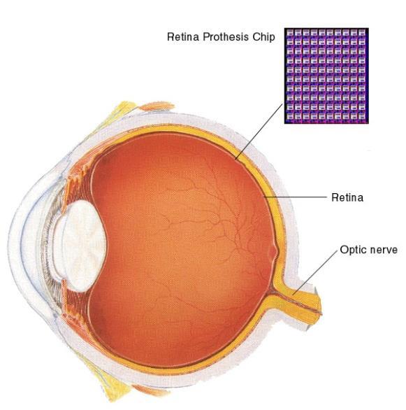 mesterséges retina 2015.