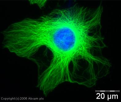 Mikrofilamentum 20 µm citokeratin (PANC1) alfa-tubulin (HeLa)