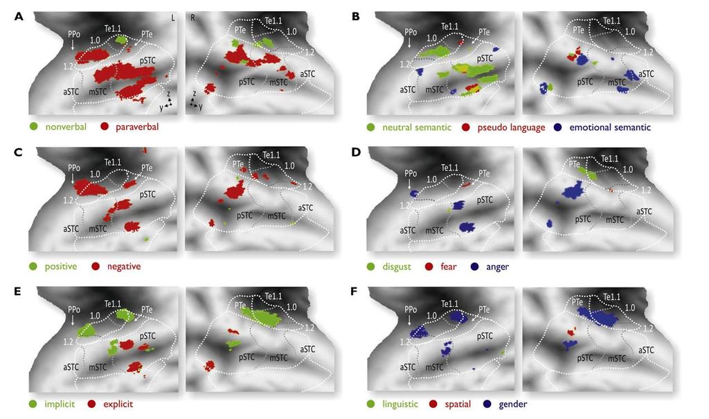 Érzelem kiolvasása a hangból: a temporalis cortex specificitása 27 tanulmány meta-analízise alapján A: non-verbális vs. paraverbális hanginger B: semleges jelentés vs. ál-nyelv vs.