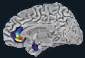 PFC/amygdala: input a monoaminerg túlaktivációja pályákból (szerotonin,