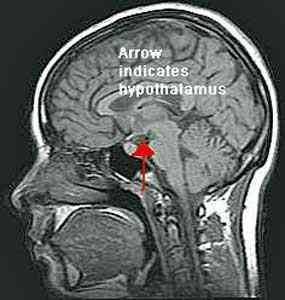 2. Az alacsony aktivitású MAO-A és a negatív életesemények kölcsönhatása:antiszociális viselkedés, externalizáció Hypothalamic