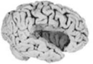 A kiterjesztett limbikus rendszer koncepciója Insula Le grand lobe limbique (Broca,