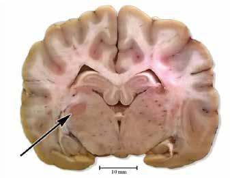 MAGYAR ÁLLATORVOSOK LAPJA 2015. FEBRUÁR 2. ÁBRA. A daganat CT-vizsgálattal és in situ (nyilak) FIGURE 2. CT-examination image and pathological picture of the tumour (arrows) 3. ÁBRA. A daganat síkjában felvett háromirányú CT-felvétel (nyilak) FIGURE 3.