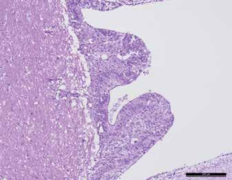 KISÁLLAT EPENDYMOMA ÉS SZERZETT MÁJELÉGTELENSÉG 6. ÁBRA. Papillaris mikroszkópos megjelenésű, intraventricularis ependymoma H.-E., 100, Bar = 200 µm FIGURE 6.
