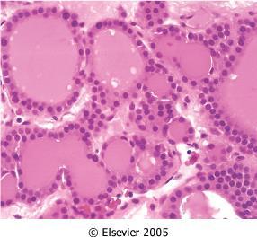 Histologiai typusai a follicularis epithel fejlődési