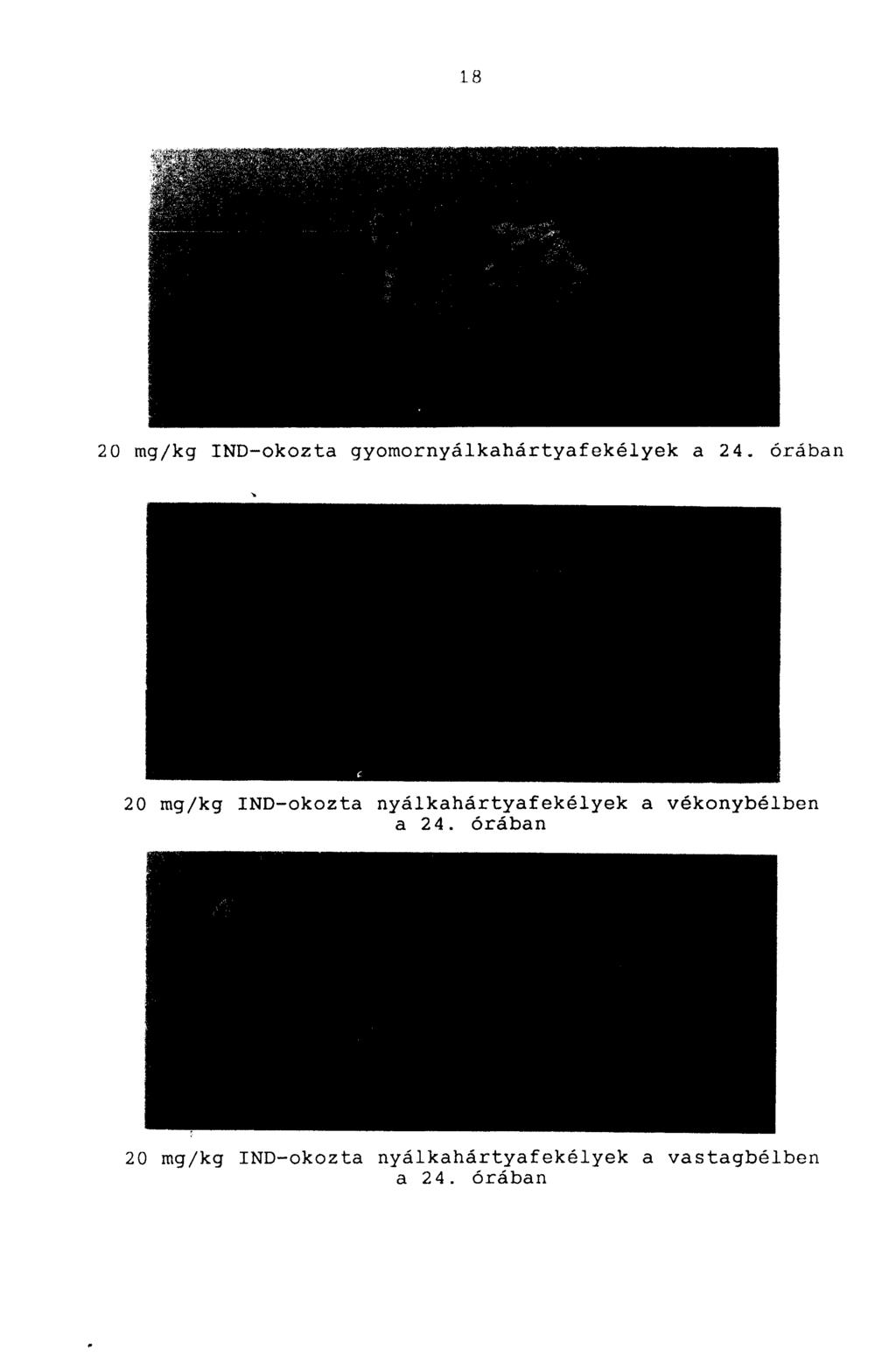 18 20 mg/kg IND-okozta gyomornyálkahártyafekélyek a 24.