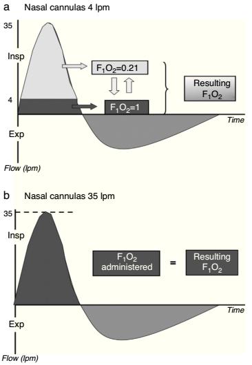 stabilabb, magasabb FiO 2 biztosítása Hatások FiO 2 a PIF közel áll az eszköz által biztosított flow-hoz, ezért a FiO 2 konstans marad Ritchie JE et al. Anaesth Intensive Care 2011; 39:1103 1110.