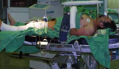 Polytrauma ellátás