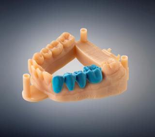 A 3D nyomtatás, más néven additív gyártás, egy olyan eljárást takar, amely során valamilyen alapanyagból