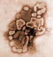 1918 Spanish Flu decimated the world over a two year span 50-100 million died Avian subtype of H1N1 2004-2005 H1N1 present in human population Accounted for minimal percentage of total Influenza