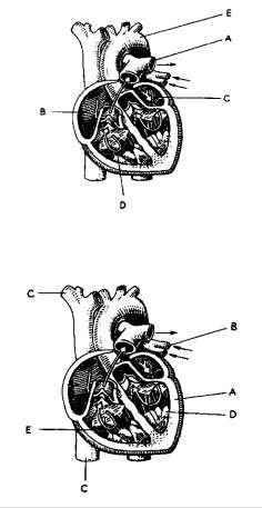 61. Melyik két artéria oszlik a könyöknél az a. Brachialis (felkar artéria)? a) a radialis és az a. Ulnaris (orsócsonti és singcsonti) b) a tibialis és a posterior (sípcsonti elülső és hátulsó) c) a.