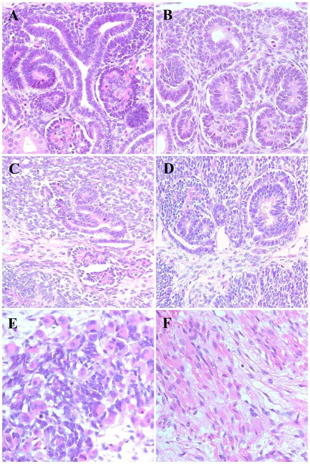 4. Ábra. A, B. Az elágazódó UB köré csoportosult blasztéma sejtjei, kezdődő tubuláris és glomeruláris formációk fötális vesében. C, D.