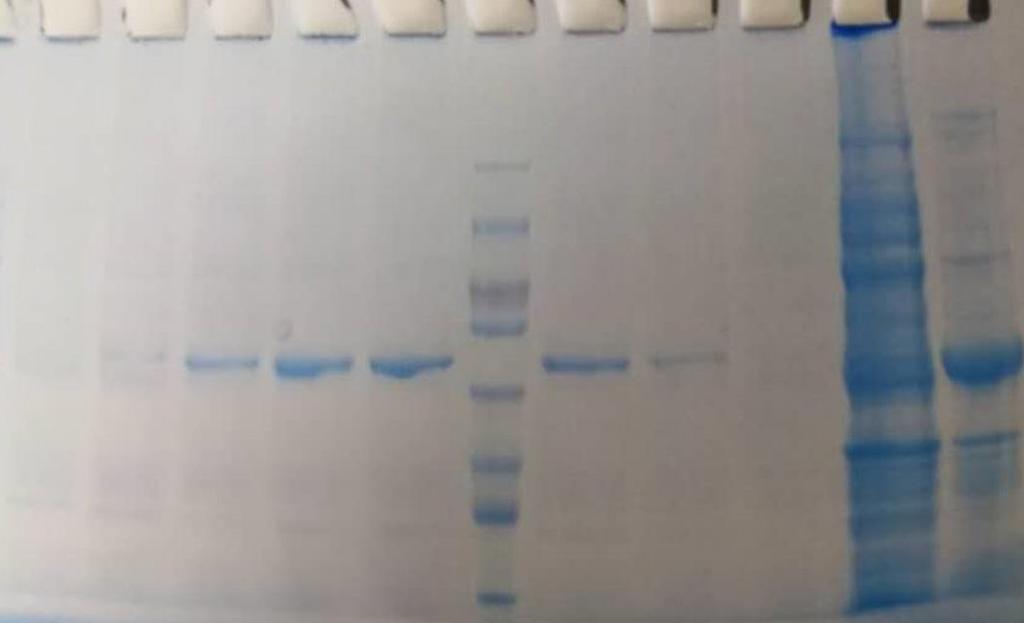 D-PAGE gel of ure protein purification The