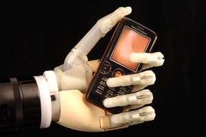 A világ első bionikus ujja (Touch Bionics)