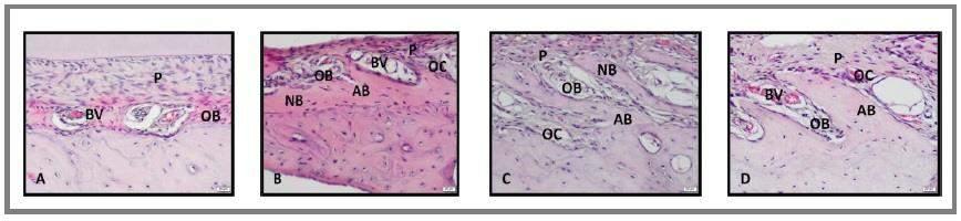 Geçgelen Cesur M et al. Table 1. Effect of low intensity pulsed ultrasound stimulation on tooth movement. Group 1 Group 2 Group 3 Group 4 Tooth movement (mm) - 2.00 ± 0.12 1 2.23 ± 0.45 2.51 ± 0.