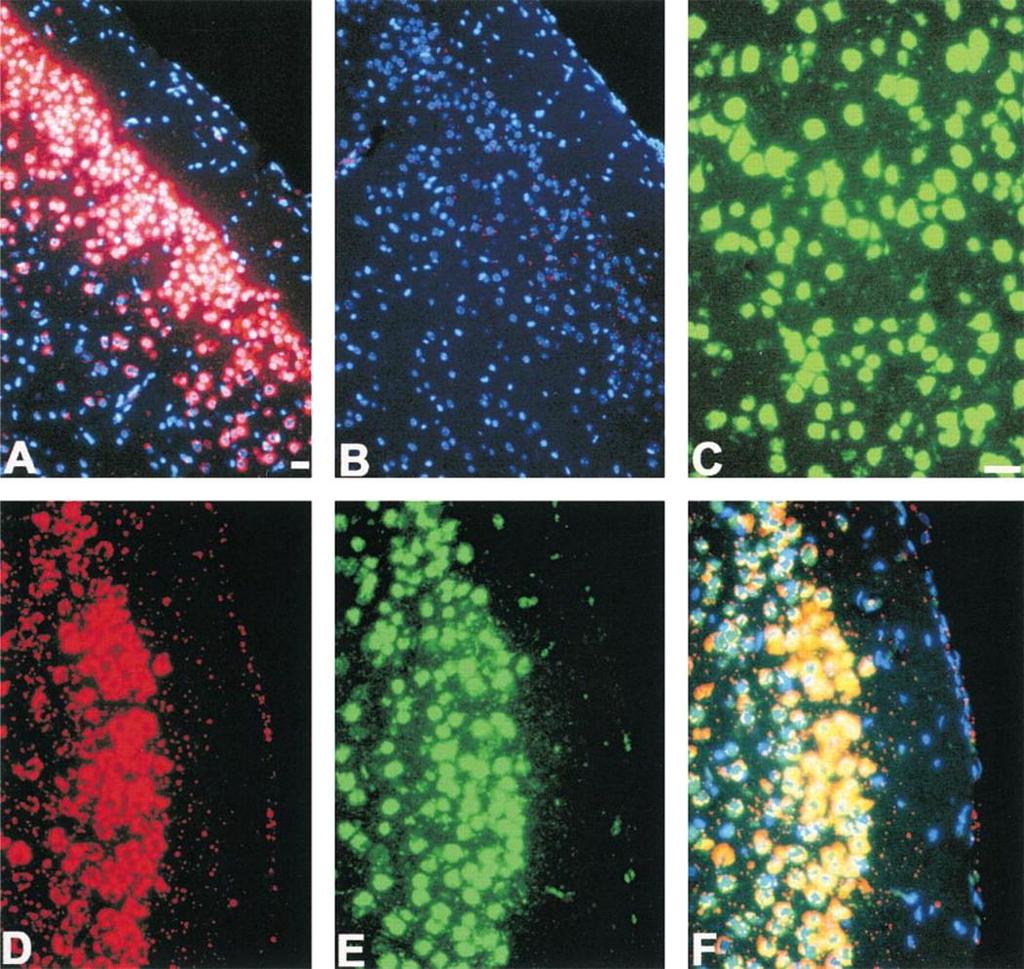 Molekuláris biológiai módszerek Nukleinsav kimutatása FISH + klasszikus immuncitokémia Zöld: Neu-N - idegsejt Kék: Hoechstfestés - mag Piros: gliális neurotrofikus faktor receptor mrns