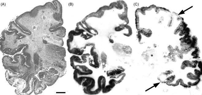 receptorszám változás mennyiségi kimutatására GluR alegységek területi megoszlása patkányban Beliczai et al