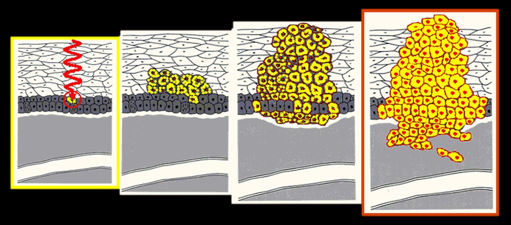 Sztochasztikus károsító hatás Kezdeti találat Dysplasia