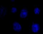 F wtdis3l2 G Ab: α-flag mtdis3l2 del9 DAPI Merge H Ab: α-flag mtdis3l2 del6 DAPI Merge Ab: α-flag DAPI Merge Supplementary,Figure,4.!Cellular,localisa6on,of,DIS3L2.,Exogenous!expression!of! DIS3L2!