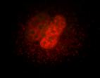 DIS3L2! in! HeLa! (C)! and! COS7! cells! (D,! E)! verified! cyctoplasmic! localiza7on! of! DIS3L2.! An! exon! 9Bdele7on! mutant! localised! in! the! cytoplasm!with!a!similar!pa[ern!as!wtdis3l2!