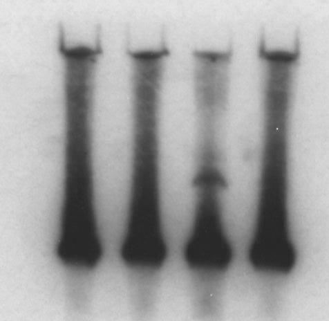 RNA ct Ct Oligo hrrp40 KD DIS3L2 KD 7S rrna 5.8S rrna Supplementary,Figure,6.,DIS3L2,ac6vity,is,not,involved,in,5.8S,rRNA,matura6on., Hela! cells! were! transfected! with! RNAi! oligos! against!