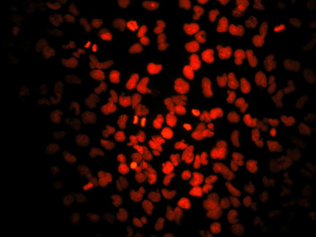 EV! Wt!DIS3L2! 600 500 No.!of!cells! 400 300 200 100 0 1 2 3 4 5 6 7 No.!of!nuclei!