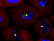 Ct!RNAi!Oligo! DIS3L2!KD! GamaBTubulin!