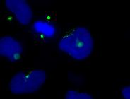 D, Ct!RNAi!Oligo! DIS3L2!KD!