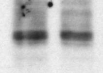 DIS3L2,knock,down,or,over,expression.!Western!blot!
