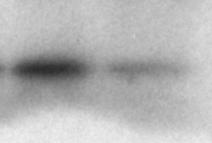 predominantly! in! its! ac7ve,! cell! cycle! inhibi7ng,!