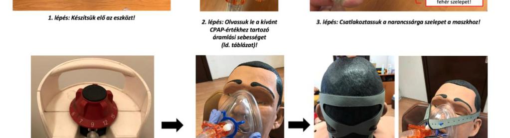 Új technikák a légzési elégtelen betegek ellátásában NIV az Országos  Mentőszolgálatnál - PDF Free Download