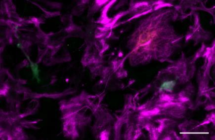 (neuron+glia) E14-15 patkány agykéregből, 7 napos