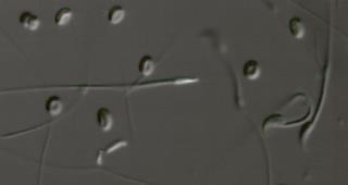 10 µm Vizsgálatainkat azonos érettségi állapotban lévő spermiumok esetében is elvégeztünk, ehhez ejakulált ondót gyűjtöttünk a homozigóta egerektől.