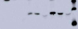 4.2.2. VÉNUSZ FEHÉRJE KIFEJEZŐDÉSÉNEK VIZSGÁLATA WESTERN BLOT ANALÍZISSEL A TEJBEN ÉS ANNAK KÜLÖNBÖZŐ FRAKCIÓIBAN Makroszkópos vizsgálataink eredményét western blot analízissel is megerősítettük (19.