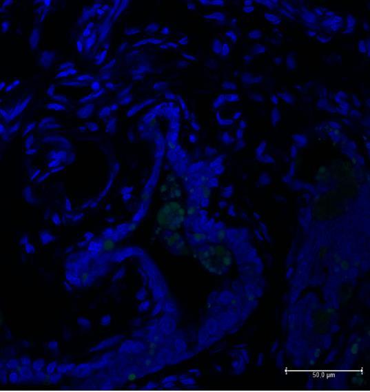 A sejtmagfestést TO-PRO 3 Iodid (Thermo Fisher Scientific, USA, T3605), a képeket 400X nagyítás mellett készítettük PMT detektorral ellátott Leica TCS SP8 konfokális mikroszkóppal, a méretskála
