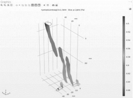 Eredmények 9 páciens légútjának 3 dimenziós modelljét készítettük el a 3D Slicer segítségével.