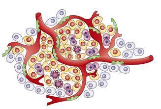 Alacsony MAPK - Portális vérellátás - A rosszul differenciált szubpopuláció klonális
