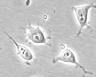 anoikis 10 µm Megfelelı szilárd aljzaton, a sejt-felszín /