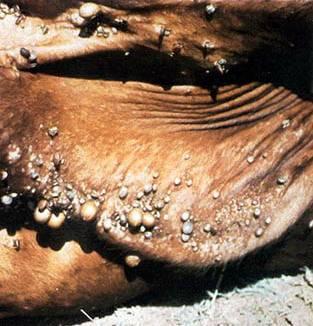 degá (Ticks) karrtytbinitüdegá BUCeKaenARbeTseyIgmanPaBFn;eTAnwg degá ehsb uy nig ekakñúgrsuk karbüa)alefvieligenaebledlekexijdegá jielisbi 40-50 k,al manenaelixøünstv ebjedayqam